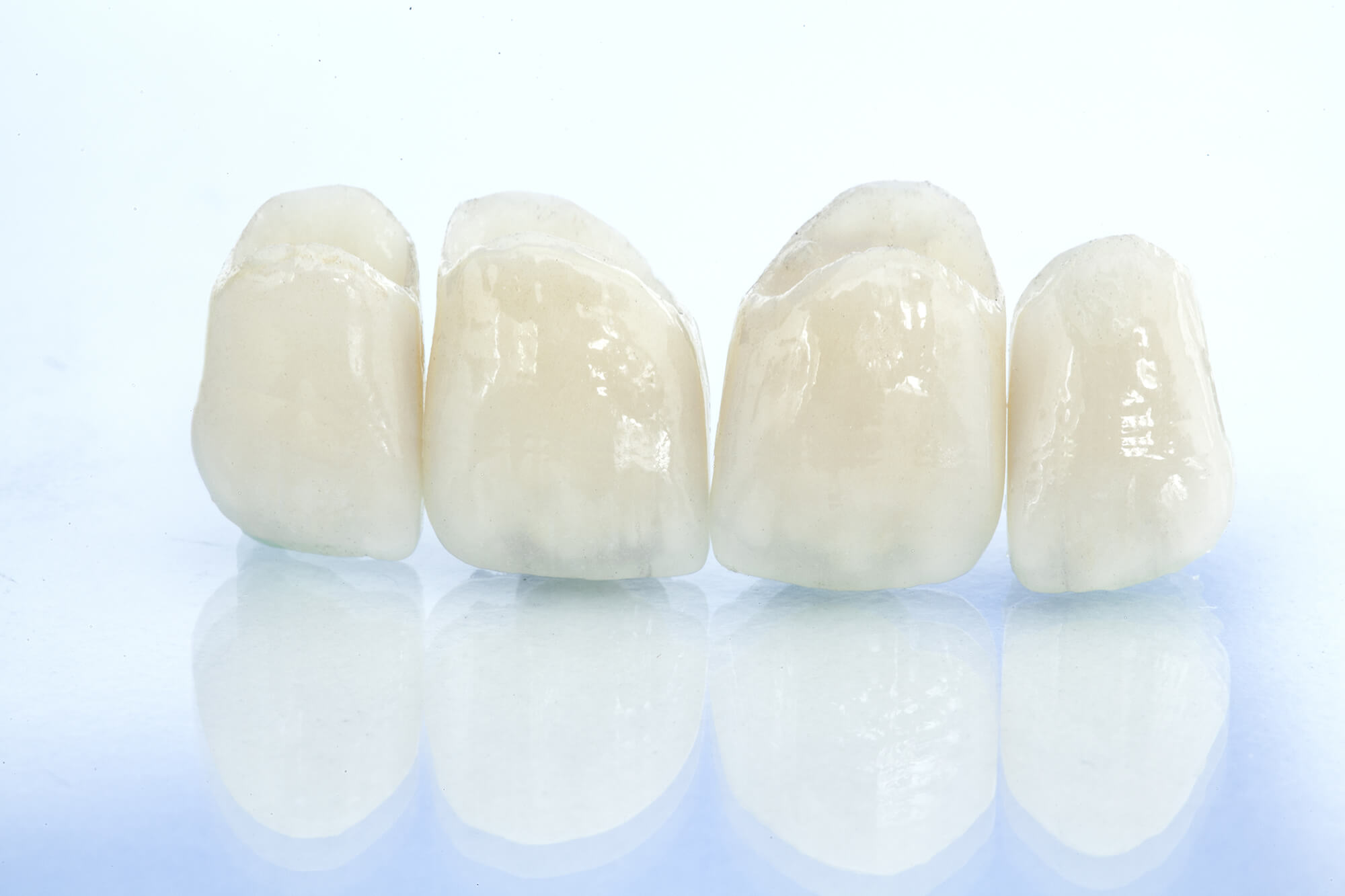 Коронки на зубы циркониевые - установить коронки циркониевые