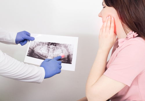Как вылечить кисту зуба, и почему не надо тянуть с визитом к врачу