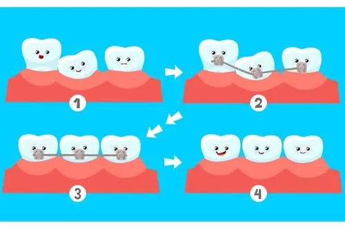 Исправление зубов: ошибки, которые отдаляют от результата и советы, как их избежать