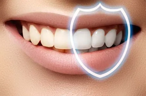 Отбеливание зубов: плюсы и минусы, о которых стоит помнить